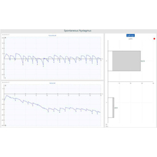 ビデオ式眼振計測装置 Visualeyes525 ゼロシーセブン Powered By イプロス